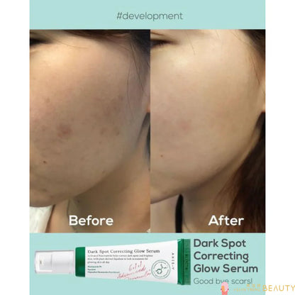 AXIS-Y-Dark Spot Correcting Glow Serum